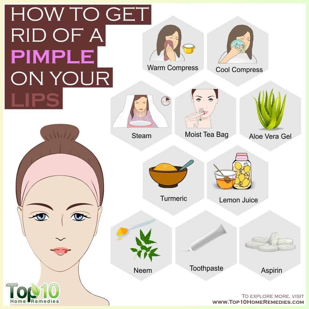 How to Get Rid of a Pimple on Your Lip | Top 10 Home Remedies | Pimples, Pimples on lip line, Pimples around lips